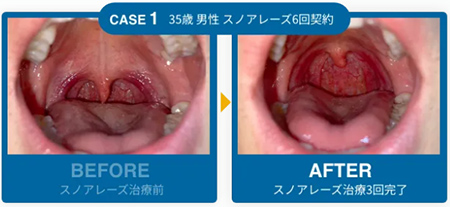 症例1の画像